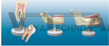 The model of molar, permanent and baby teeth